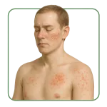 Antiallergika