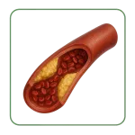 Cholesterin